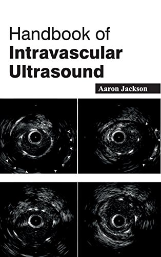 

mbbs/4-year/handbook-of-intravascular-ultrasound-9781632422088