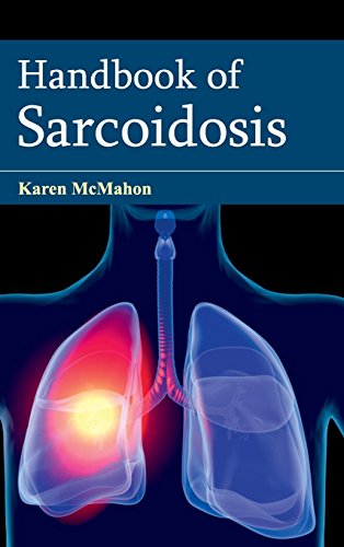 

clinical-sciences/respiratory-medicine/handbook-of-sarcoidosis-9781632422170