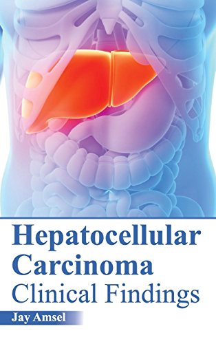 

surgical-sciences/oncology/hepatocellular-carcinoma-clinical-findings-9781632422286