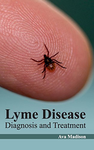 

mbbs/2-year/lyme-disease-diagnosis-and-treatment-9781632422620