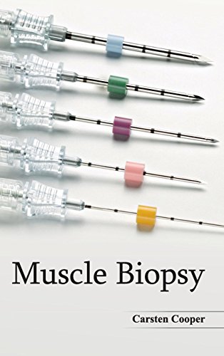 

mbbs/3-year/muscle-biopsy-9781632422804