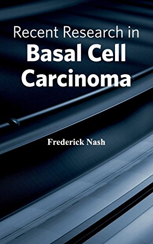 

surgical-sciences/oncology/recent-research-in-basal-cell-carcinoma-9781632423528