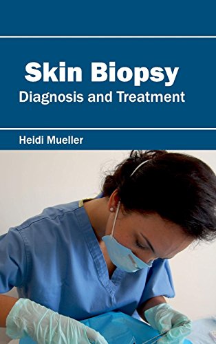 

mbbs/3-year/skin-biopsy-diagnosis-and-treatment-9781632423740