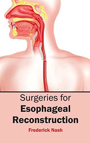 

surgical-sciences/surgery/surgeries-for-esophageal-reconstruction-9781632423832