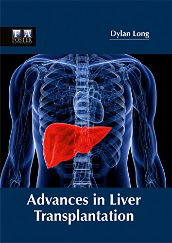 

surgical-sciences/surgery/advances-in-liver-transplantation-9781632424730