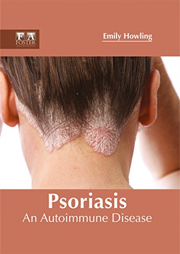 

general-books/general/psoriasis-an-autoimmune-disease--9781632424754