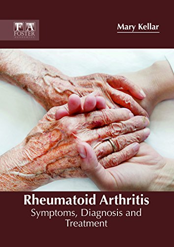 

general-books/general/rheumatoid-arthritis-symptoms-diagnosis-and-treatment--9781632425676
