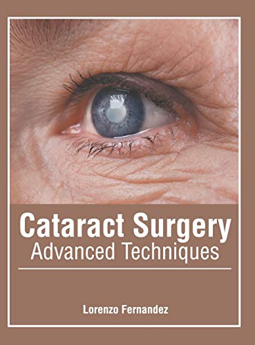 

surgical-sciences/surgery/cataract-surgery-advanced-techniques--9781632427540