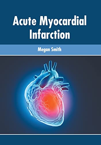 

exclusive-publishers/american-medical-publishers/acute-myocardial-infarction-9781639270125