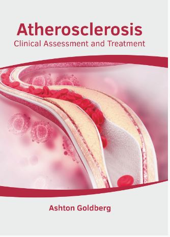 

medical-reference-books/cardiology/atherosclerosis-clinical-assessment-and-treatment-9781639270156