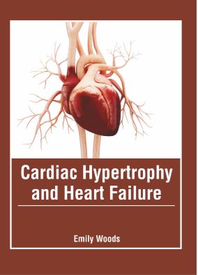 

medical-reference-books/cardiology/cardiac-hypertrophy-and-heart-failure-9781639270170