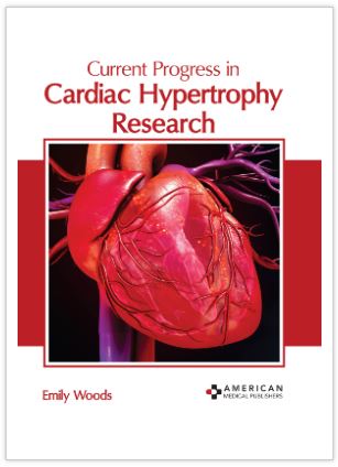 

medical-reference-books/cardiology/current-progress-in-cardiac-hypertrophy-research-9781639270255