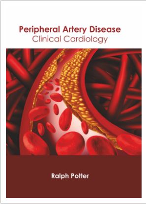 

medical-reference-books/cardiology/peripheral-artery-disease-clinical-cardiology-9781639270378