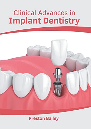 

exclusive-publishers/american-medical-publishers/clinical-advances-in-implant-dentistry-9781639270514