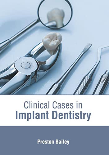 

exclusive-publishers/american-medical-publishers/clinical-cases-in-implant-dentistry-9781639270521