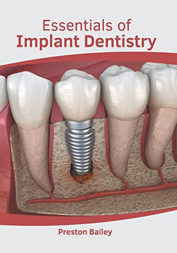 

exclusive-publishers/american-medical-publishers/essentials-of-implant-dentistry-9781639270538