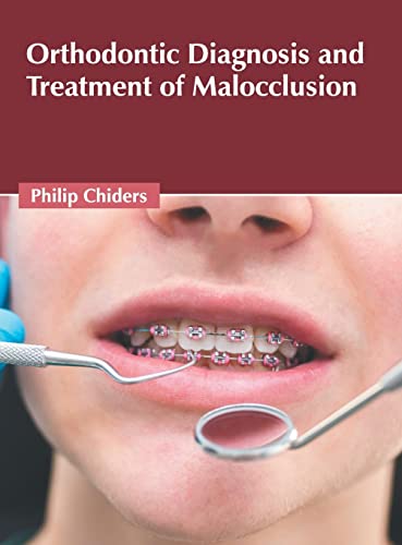 

exclusive-publishers/american-medical-publishers/orthodontic-diagnosis-and-treatment-of-malocclusion-9781639270576