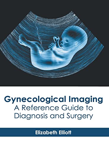

medical-reference-books/radiology/gynecological-imaging-a-reference-guide-to-diagnosis-and-surgery-9781639270712