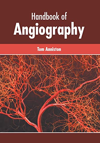 

exclusive-publishers/american-medical-publishers/handbook-of-angiography-9781639270729