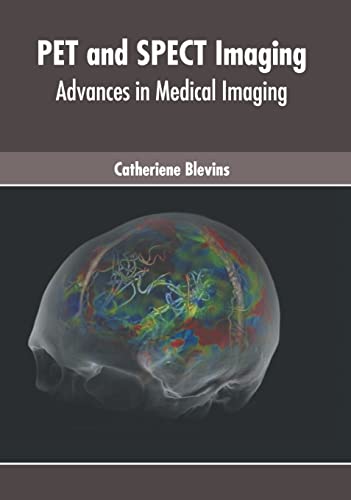 

medical-reference-books/radiology/pet-and-spect-imaging-advances-in-medical-imaging-9781639270781