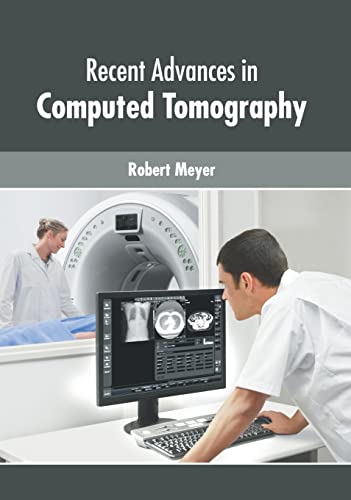 

exclusive-publishers/american-medical-publishers/recent-advances-in-computed-tomography-9781639270811
