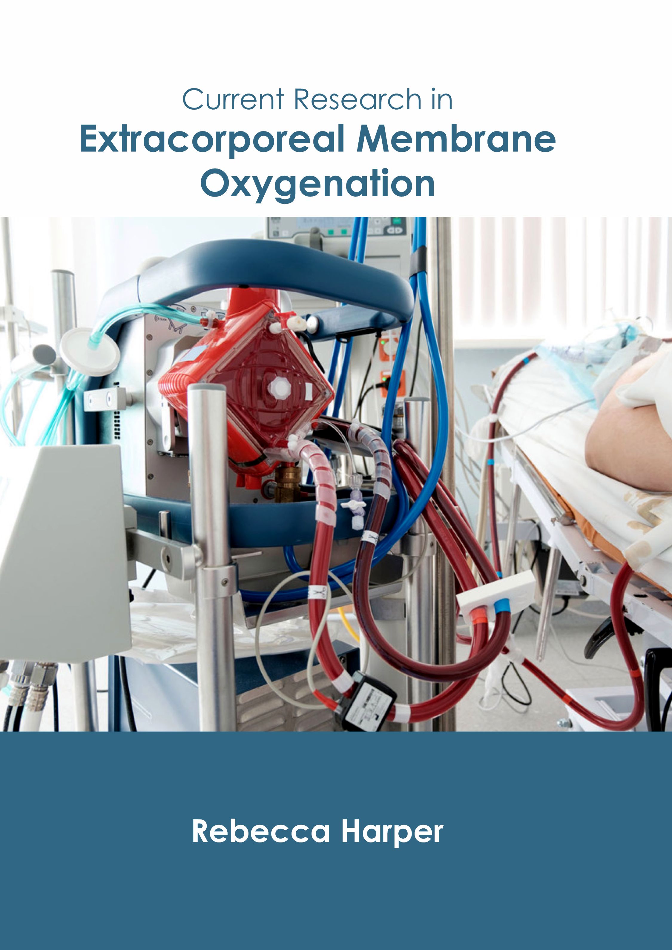 

exclusive-publishers/american-medical-publishers/current-research-in-extracorporeal-membrane-oxygenation-9781639270996