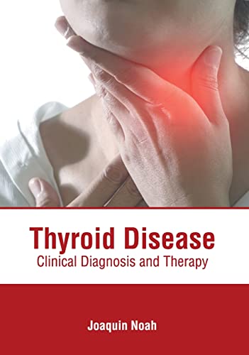 

exclusive-publishers/american-medical-publishers/thyroid-disease-clinical-diagnosis-and-therapy-9781639271269