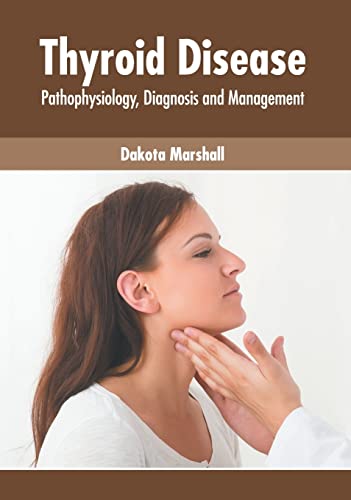 

exclusive-publishers/american-medical-publishers/thyroid-disease-pathophysiology-diagnosis-and-management-9781639271276