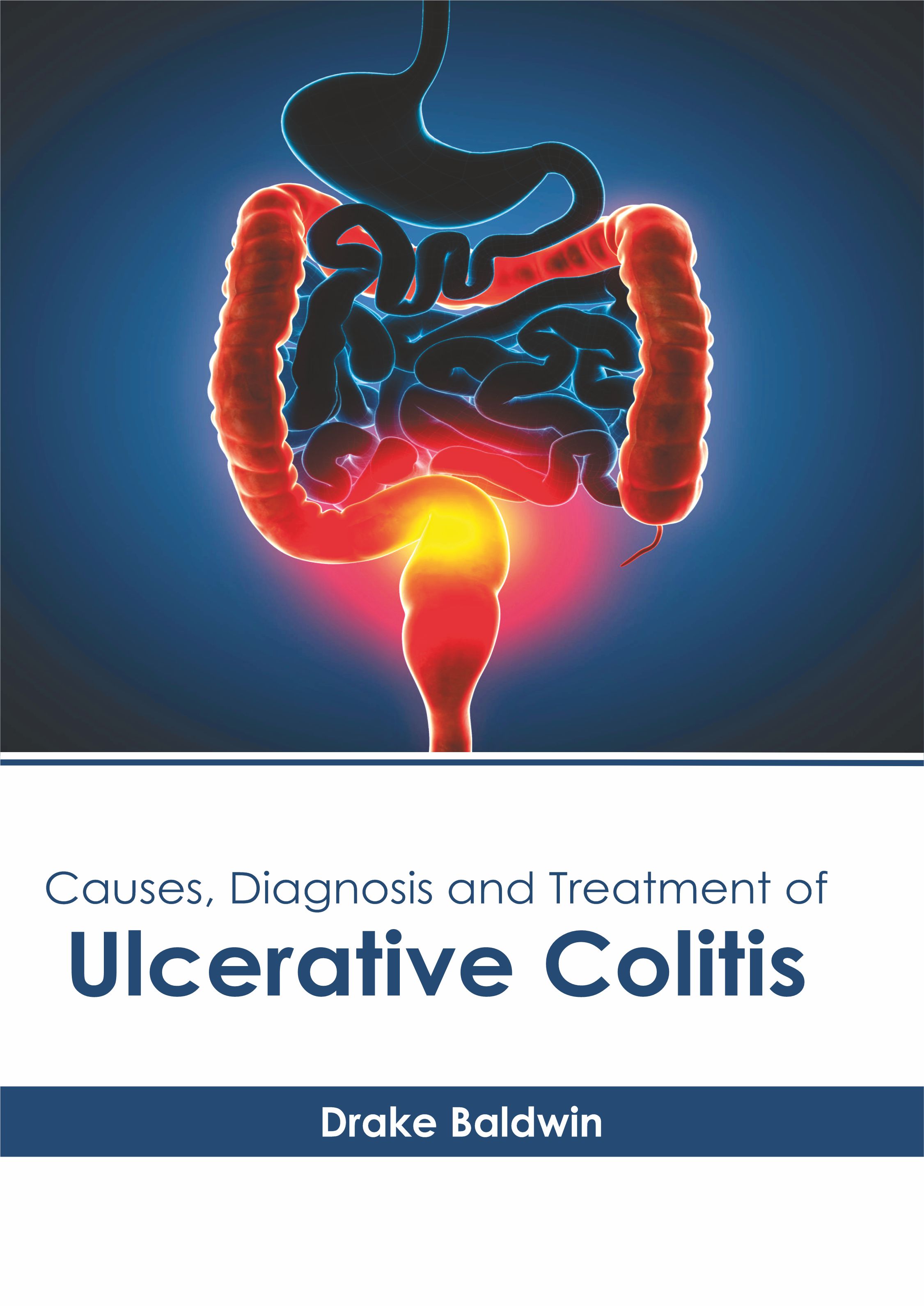 

exclusive-publishers/american-medical-publishers/causes-diagnosis-and-treatment-of-ulcerative-colitis-9781639271320