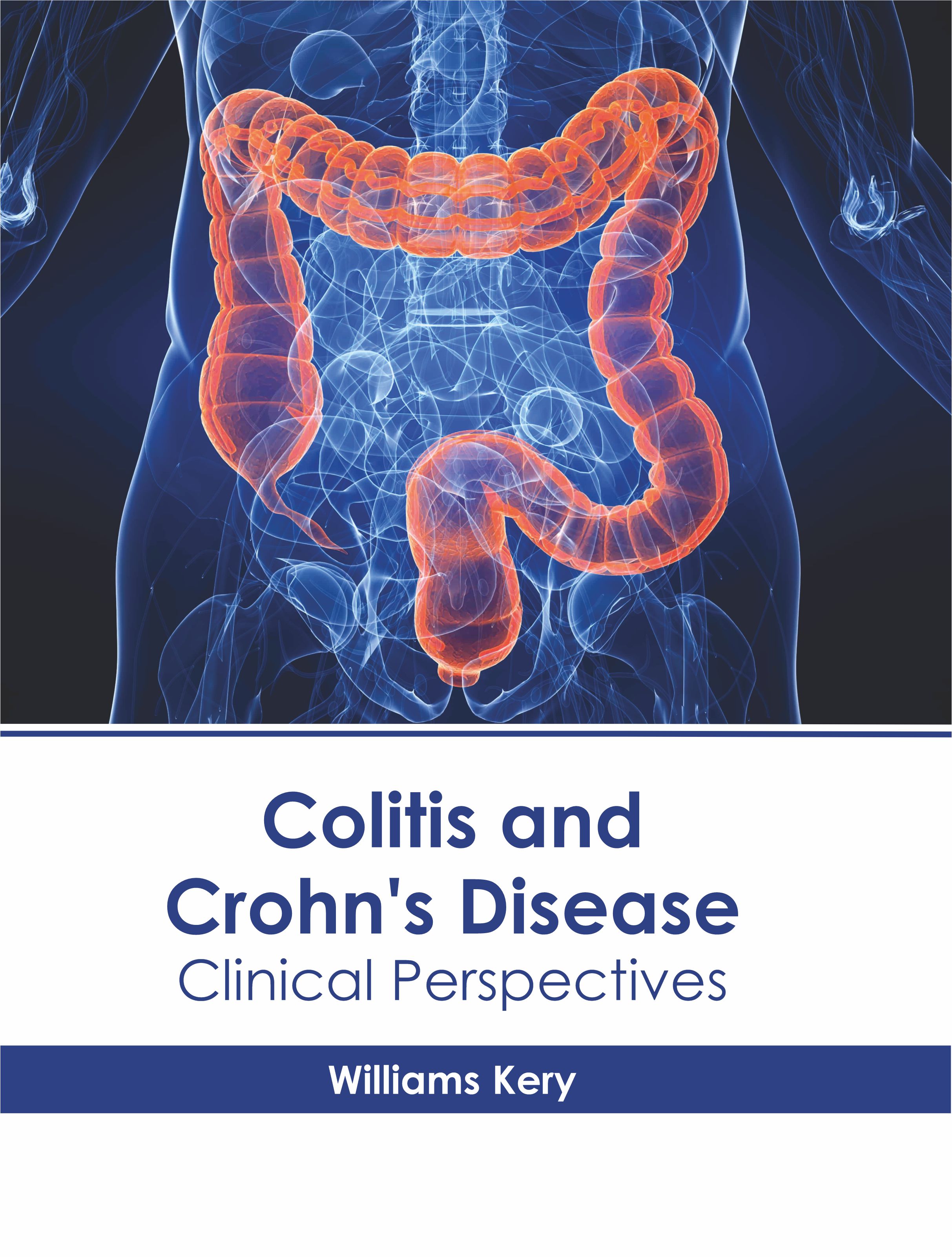 

exclusive-publishers/american-medical-publishers/colitis-and-crohn-s-disease-clinical-perspectives-9781639271337