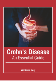 

exclusive-publishers/american-medical-publishers/crohn-s-disease-an-essential-guide-9781639271344