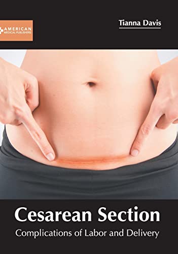 

exclusive-publishers/american-medical-publishers/cesarean-section-complications-of-labor-and-delivery-9781639271511