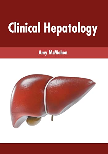 

exclusive-publishers/american-medical-publishers/clinical-hepatology-9781639271870