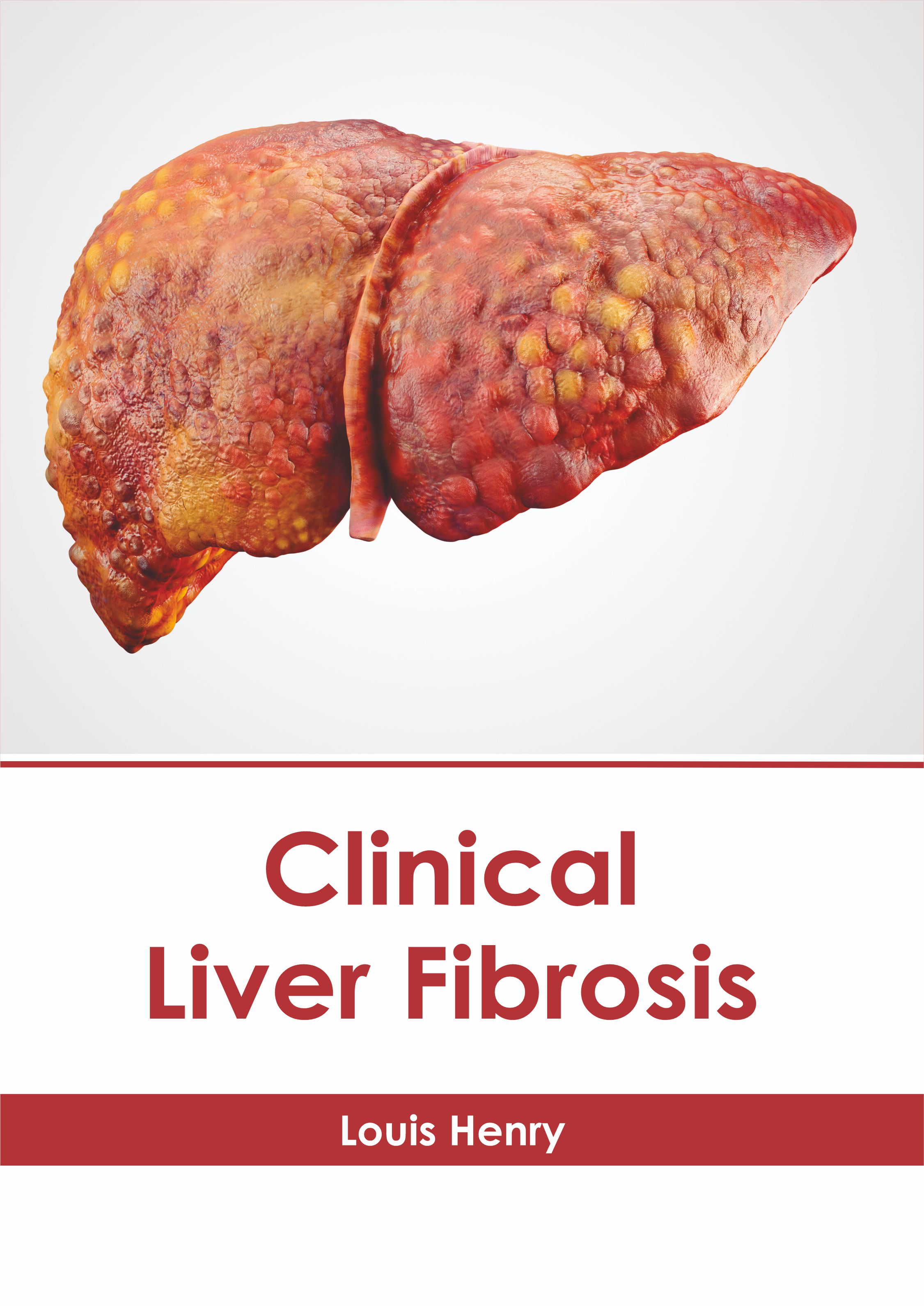 

exclusive-publishers/american-medical-publishers/clinical-liver-fibrosis-9781639271887