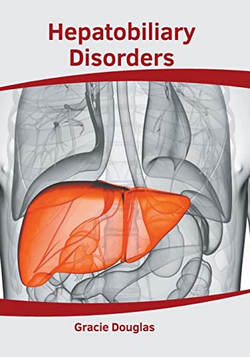 

exclusive-publishers/american-medical-publishers/hepatobiliary-disorders-9781639271931