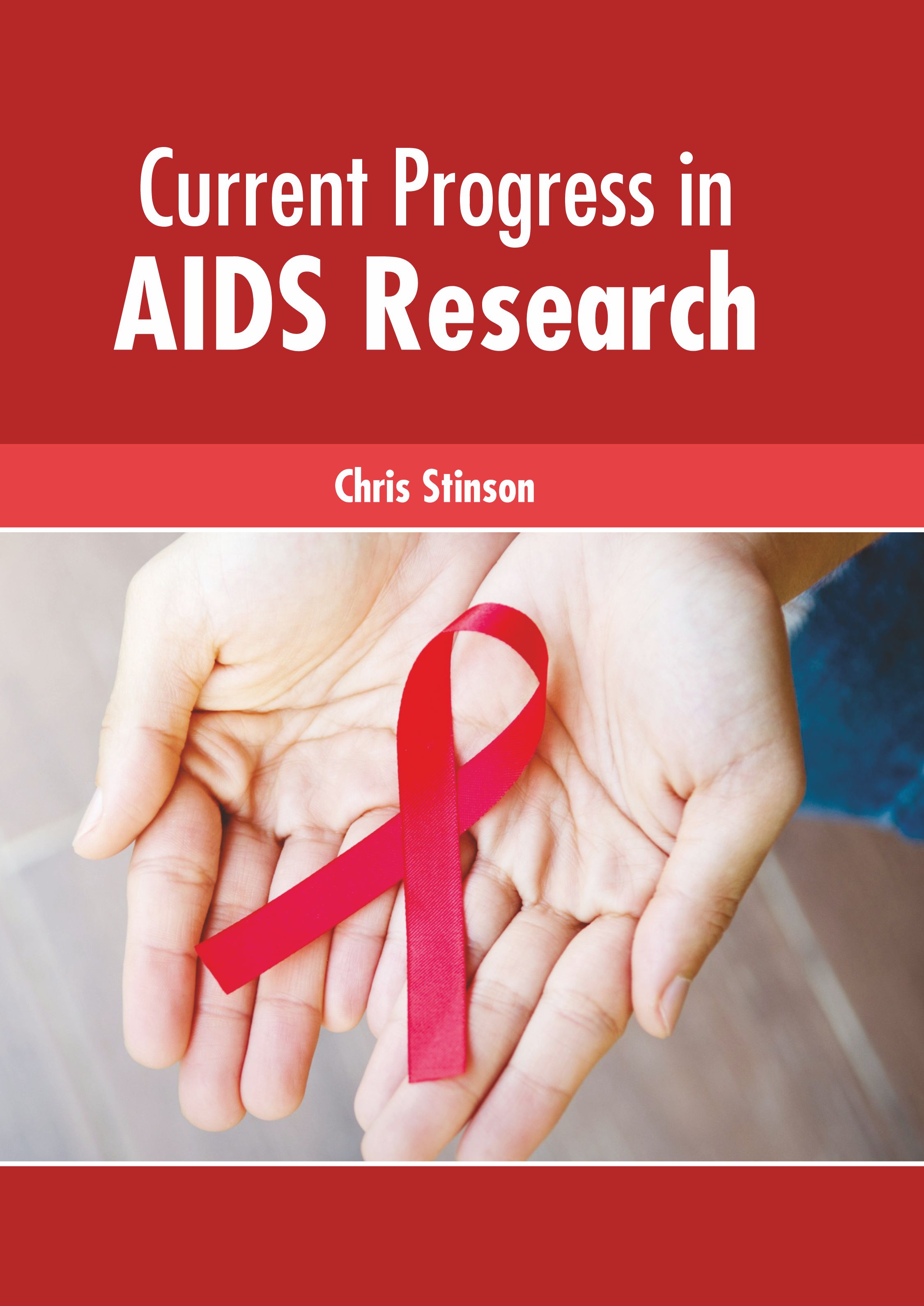 

medical-reference-books/microbiology/current-progress-in-aids-research-9781639272013