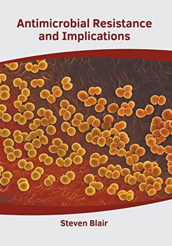 

medical-reference-books/microbiology/antimicrobial-resistance-and-implications-9781639272082