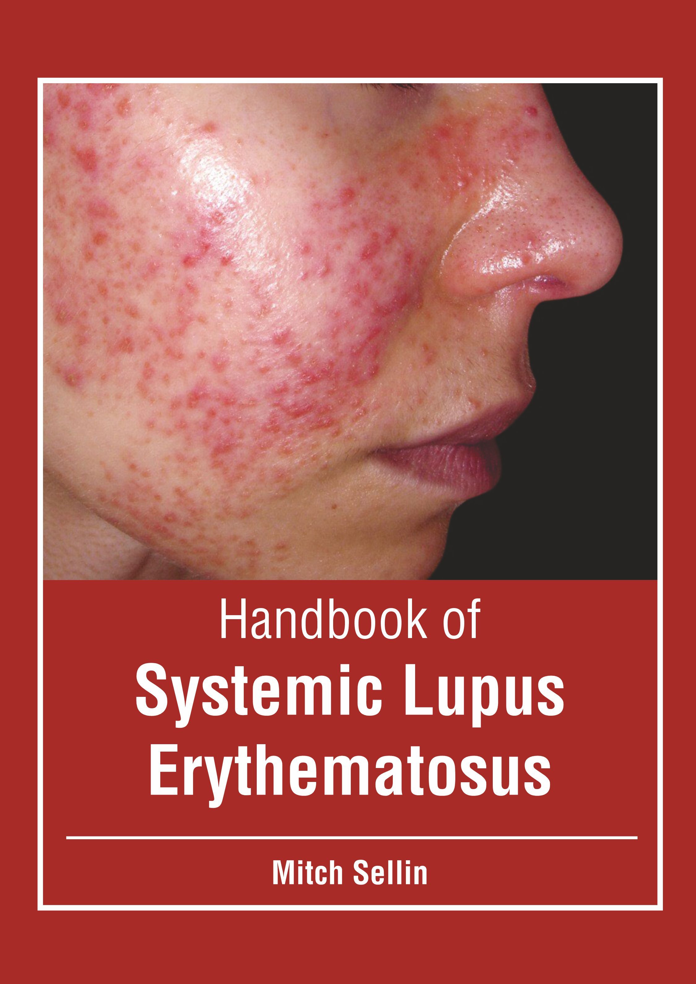 

exclusive-publishers/american-medical-publishers/handbook-of-systemic-lupus-erythematosus-9781639272112