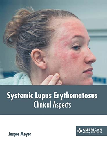 

medical-reference-books/microbiology/systemic-lupus-erythematosus-clinical-aspects-9781639272129