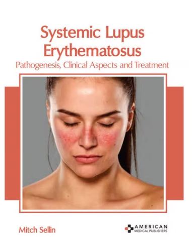 

exclusive-publishers/american-medical-publishers/systemic-lupus-erythematosus-pathogenesis-clinical-aspects-and-treatment-9781639272143