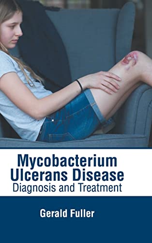

exclusive-publishers/american-medical-publishers/mycobacterium-ulcerans-disease-diagnosis-and-treatment-9781639272280