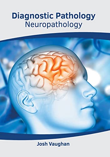 

exclusive-publishers/american-medical-publishers/diagnostic-pathology-neuropathology-9781639272914