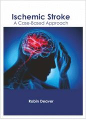 

exclusive-publishers/american-medical-publishers/ischemic-stroke-a-case-based-approach-9781639273027