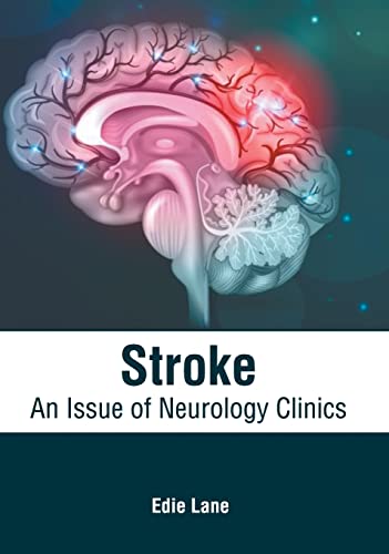 

exclusive-publishers/american-medical-publishers/stroke-an-issue-of-neurology-clinics-9781639273294
