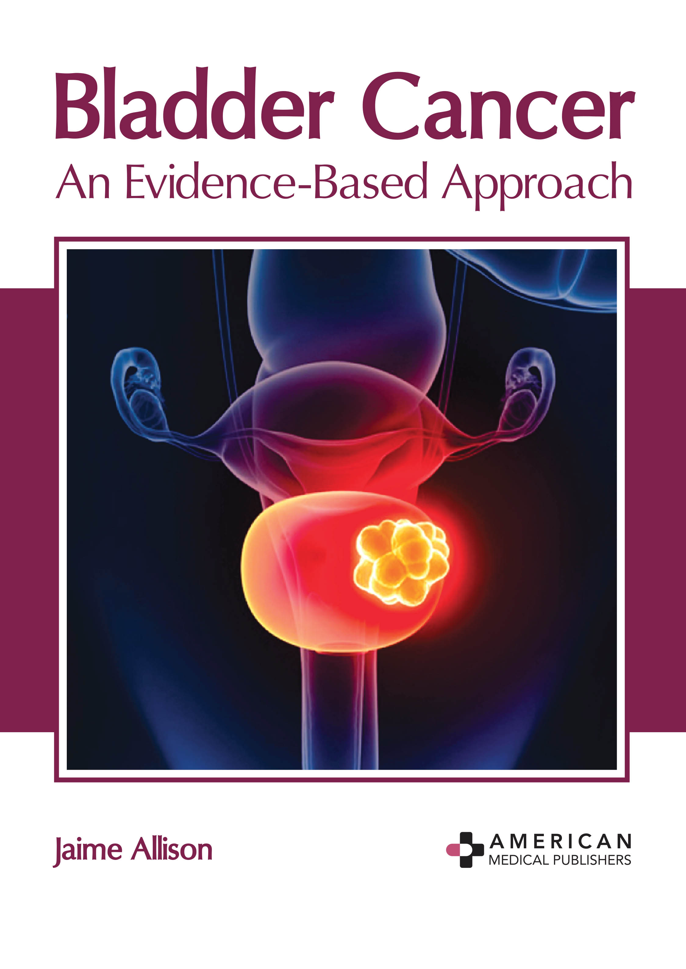

medical-reference-books/oncology/bladder-cancer-an-evidence-based-approach-9781639273379