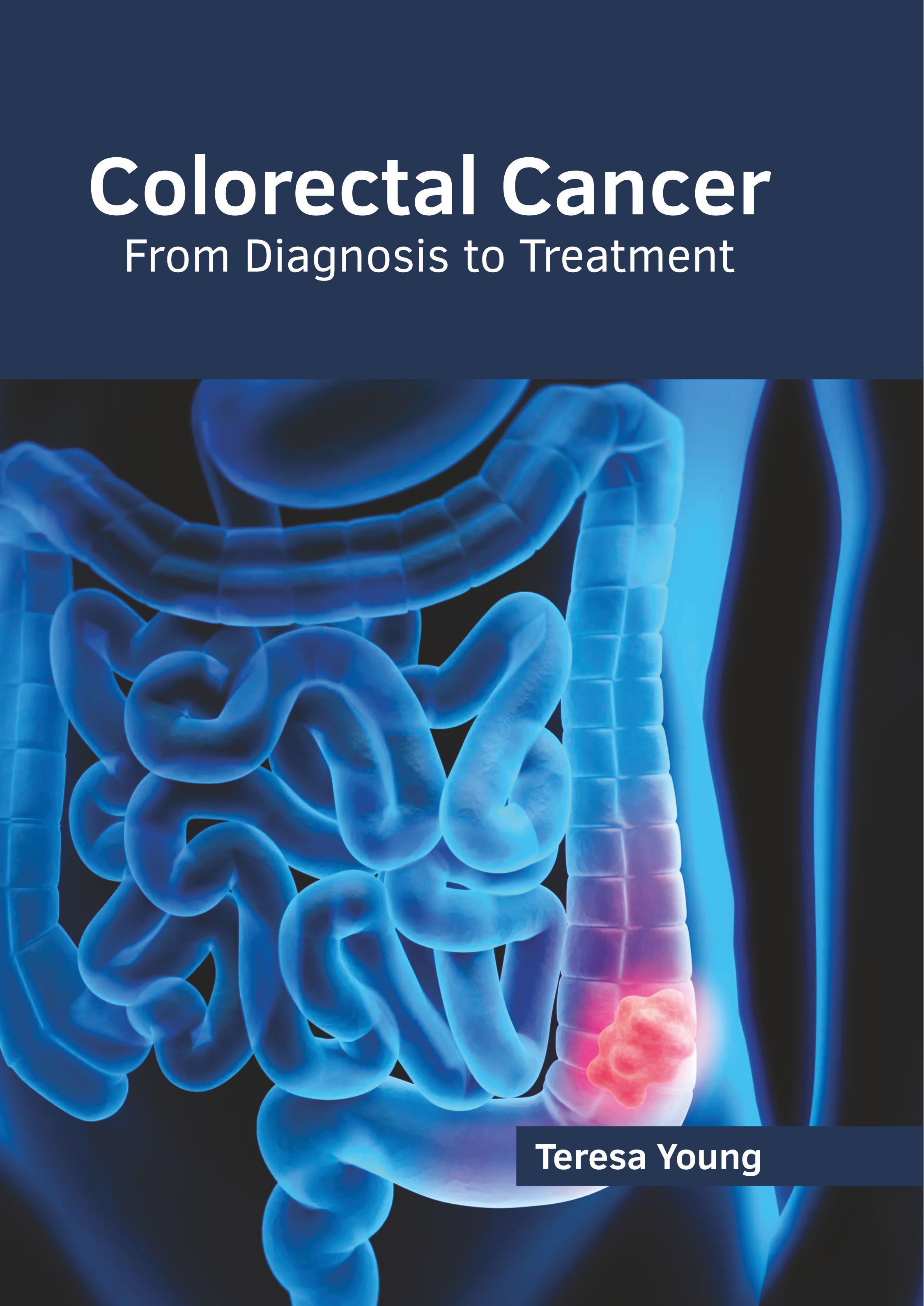 

exclusive-publishers/american-medical-publishers/colorectal-cancer-from-diagnosis-to-treatment-9781639273492