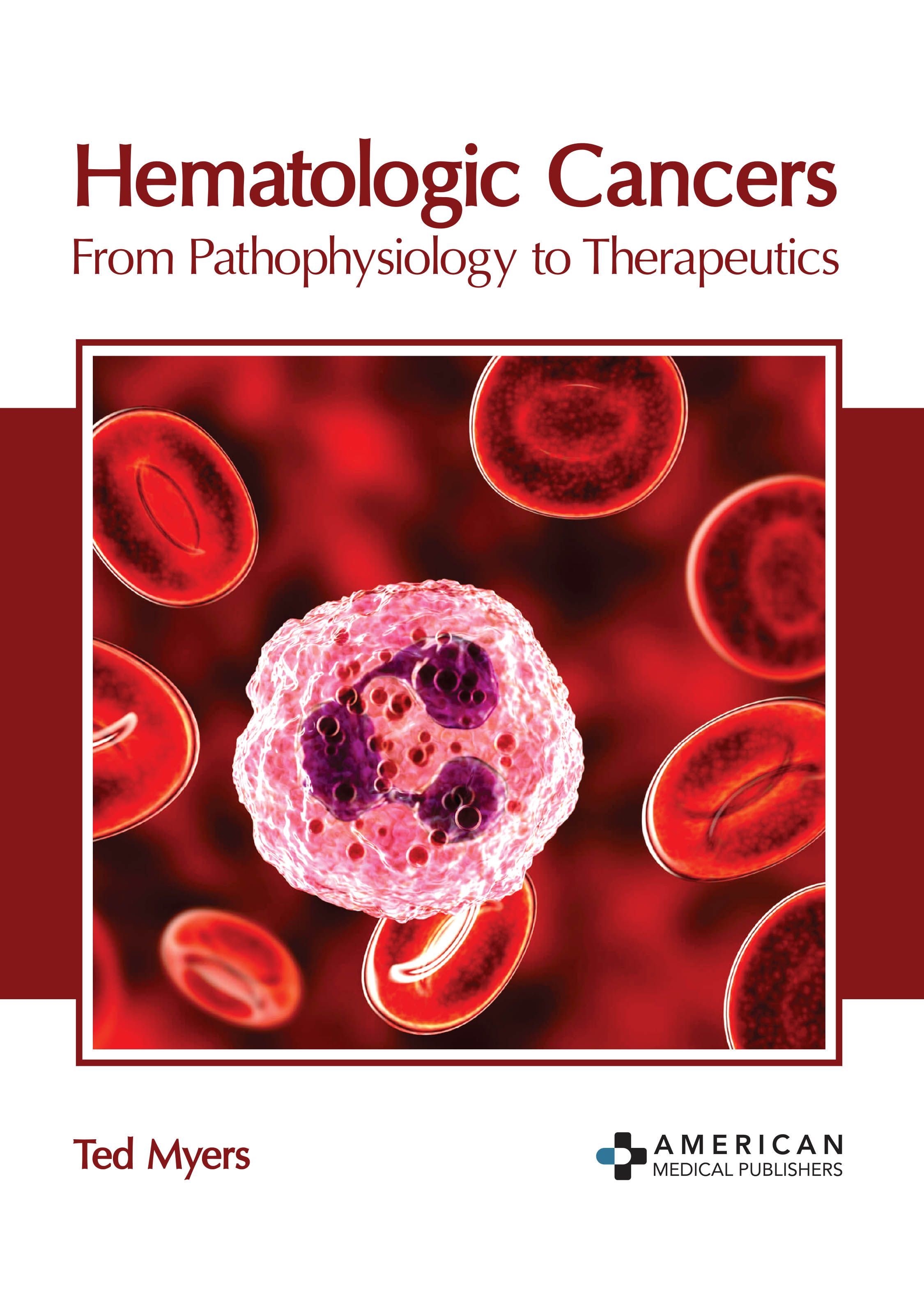 

exclusive-publishers/american-medical-publishers/hematologic-cancers-from-pathophysiology-to-therapeutics-9781639273539