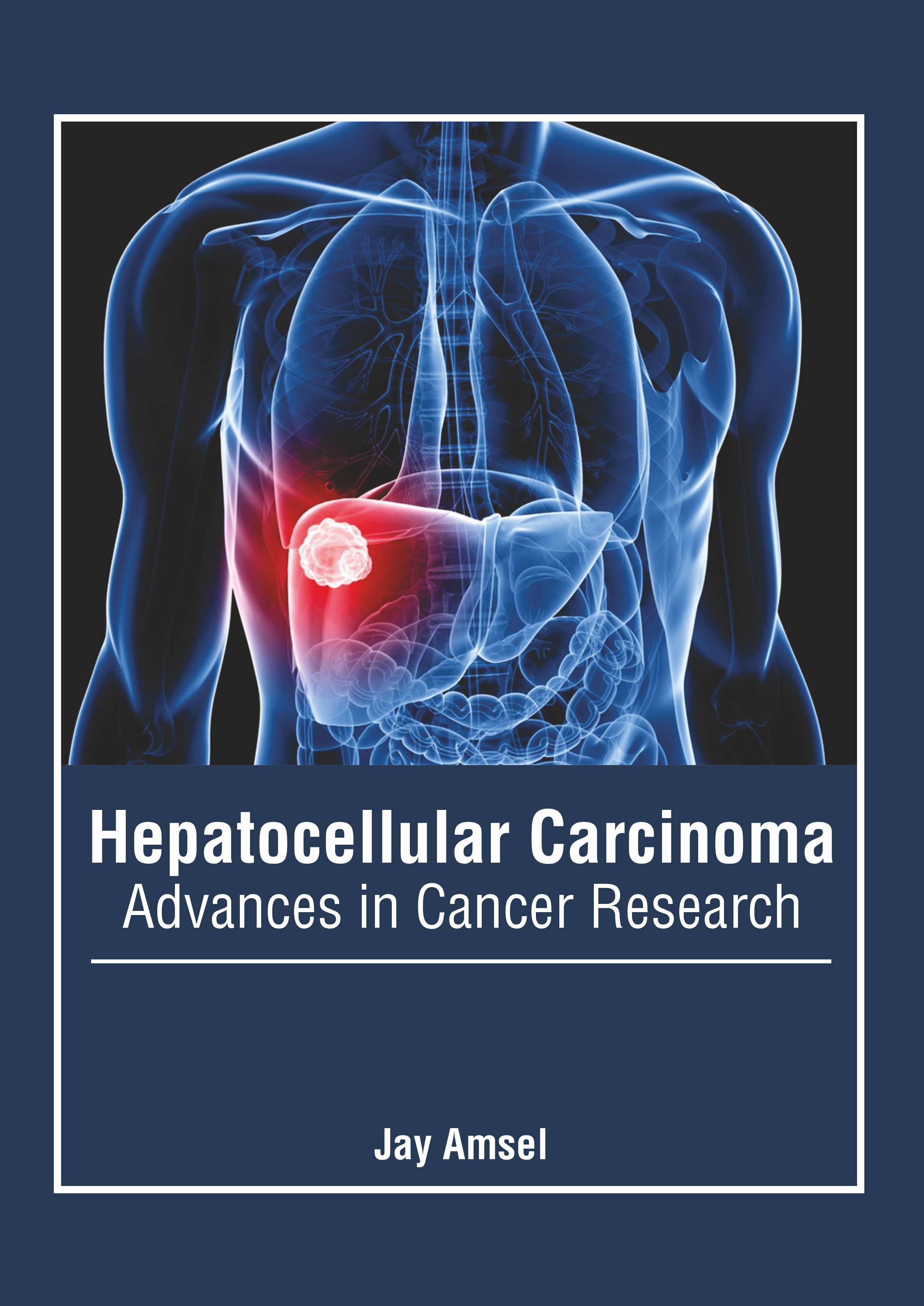 

exclusive-publishers/american-medical-publishers/hepatocellular-carcinoma-advances-in-cancer-research-9781639273560
