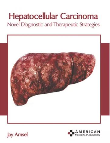

exclusive-publishers/american-medical-publishers/hepatocellular-carcinoma-novel-diagnostic-and-therapeutic-strategies-9781639273577