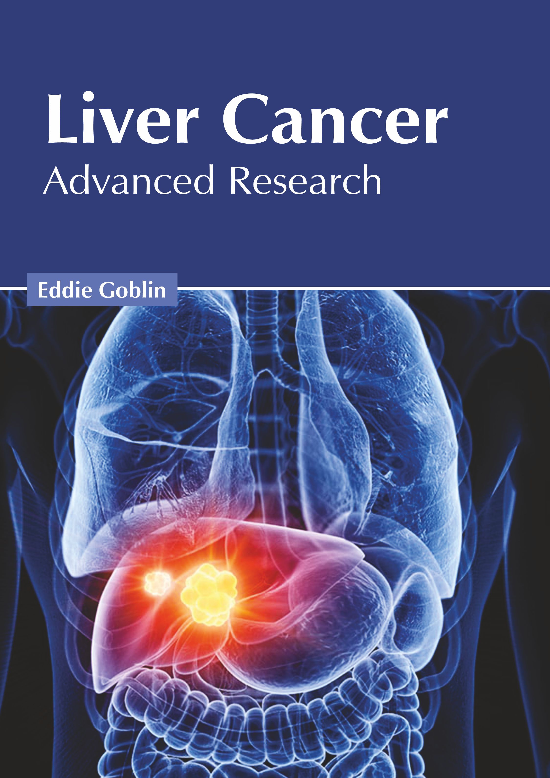 

exclusive-publishers/american-medical-publishers/liver-cancer-advanced-research-9781639273591